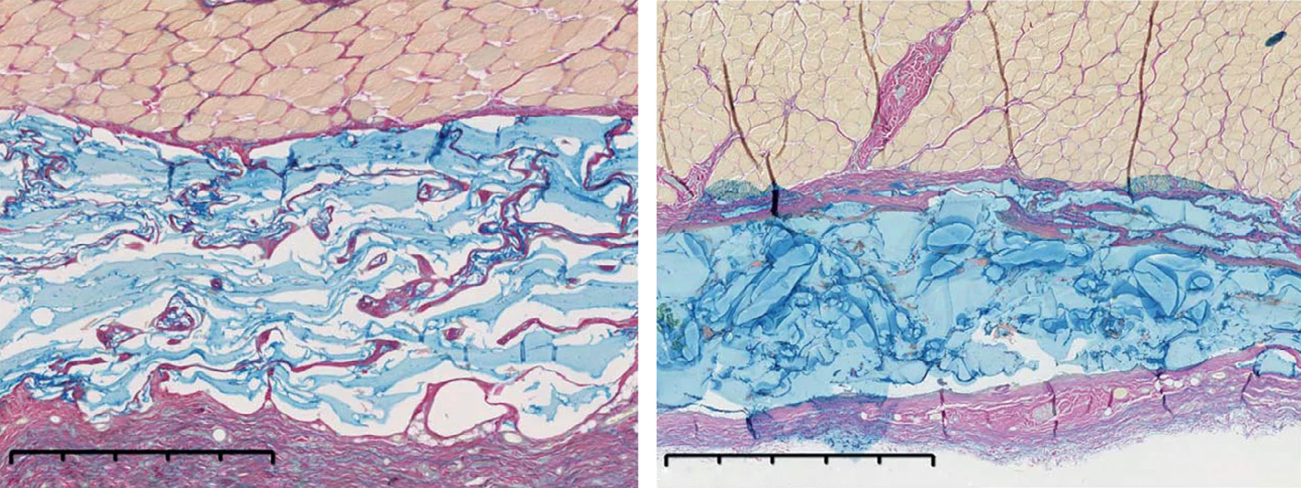 Fig 1. Integración tisular subcutánea a 4 semanas: gel homogéneo (izquierda) frente a gel particulado (derecha), van Gieson / hierro coloidal.